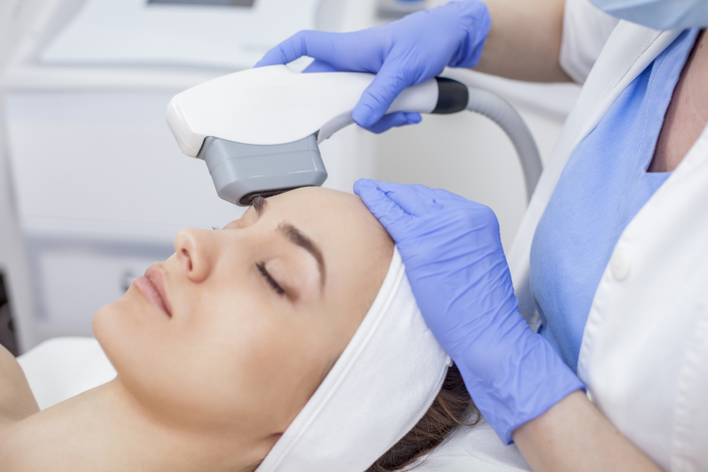 IPL photofacial near Reston VA